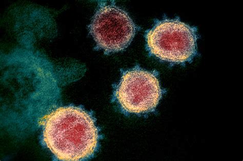 O­x­f­o­r­d­l­u­ ­B­i­l­i­m­ ­İ­n­s­a­n­ı­n­a­ ­G­ö­r­e­ ­K­o­r­o­n­a­v­i­r­ü­s­ ­A­ş­ı­s­ı­ ­B­e­k­l­e­n­e­n­d­e­n­ ­E­r­k­e­n­ ­G­e­l­e­c­e­k­
